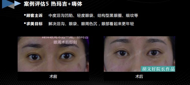 胶生灌养眼周抗衰是什么产品？