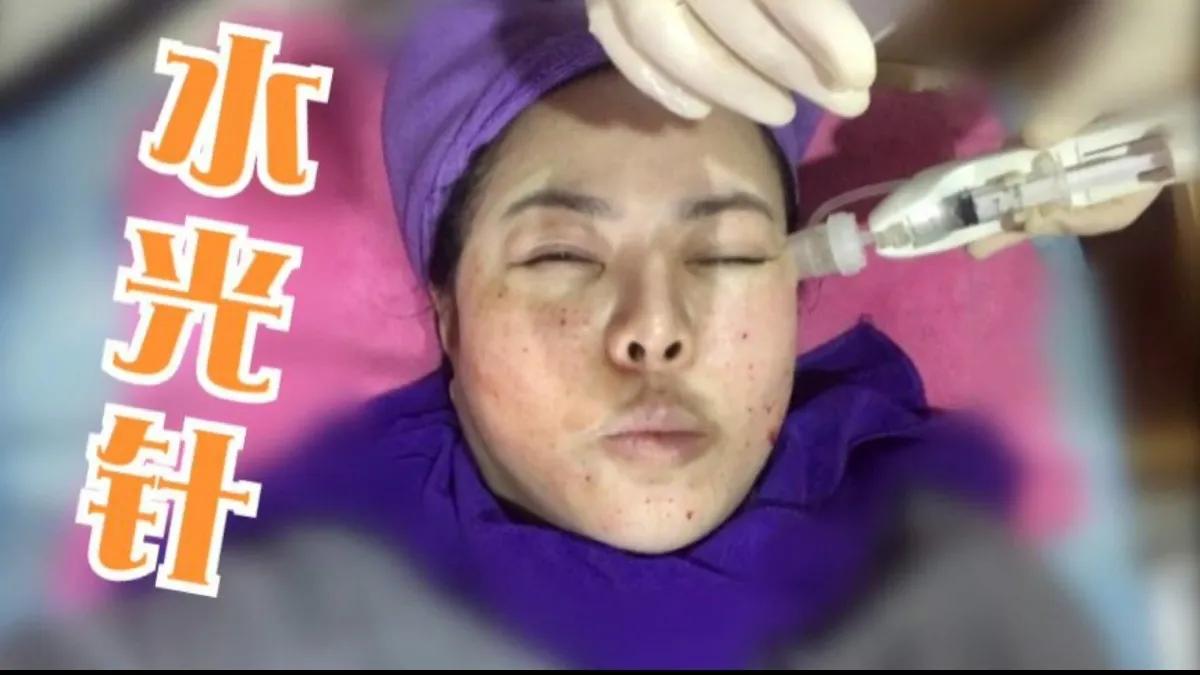 医疗美容去斑做什么项目最好,过年必做的4个医美项目