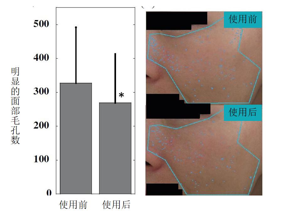 比钻石还珍贵富勒烯,中国最新发现矿物质富勒烯
