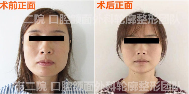 娣卞湷棰岄潰澶栫鏁村舰,娣卞湷鍙ｈ厰鍖婚櫌棰岄潰鏁村舰