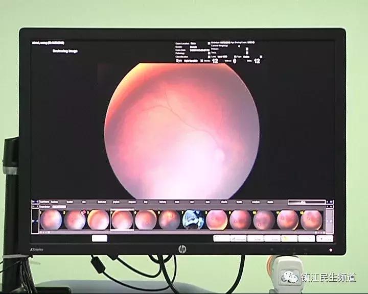 孩子出生后哪些疾病筛查有必要做,小孩出生在医院筛查会有记录吗