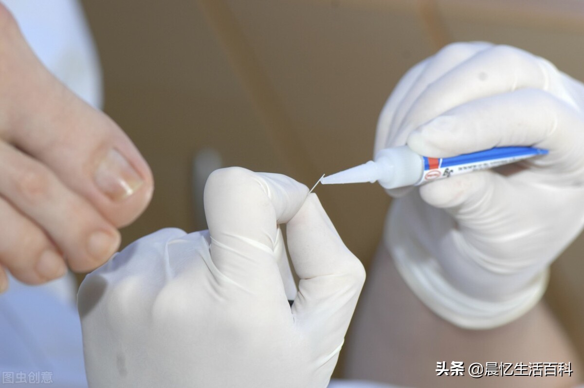 中国胶粘行业的前景,胶粘行业深度分析