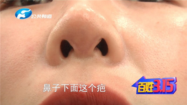 郑州康伦医院整形视频,郑州康伦整形失败案例