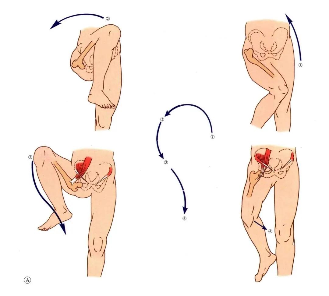 髋关节脱位闭合复位方法,髋关节脱位复位治疗过程