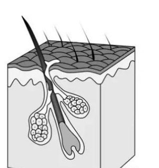 皮肤出油长痘怎么控油,皮肤出油怎么控油最有效