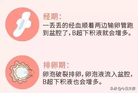 妇科b超腹部有积液是什么原因,妇科b超检查盆腔积液怎么回事