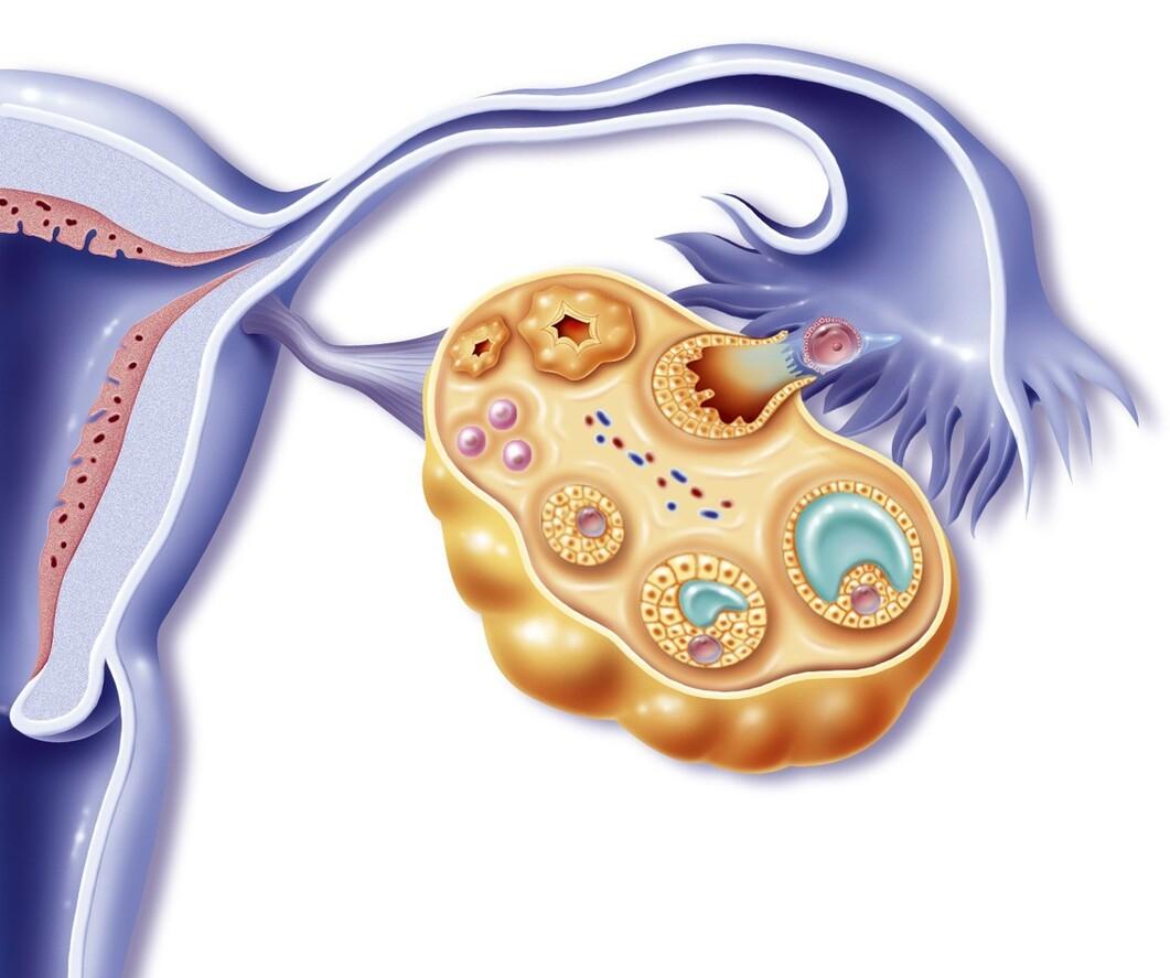 试管婴儿移植冻胚前有什么流程,自然周期冻胚移植为什么要打hcg