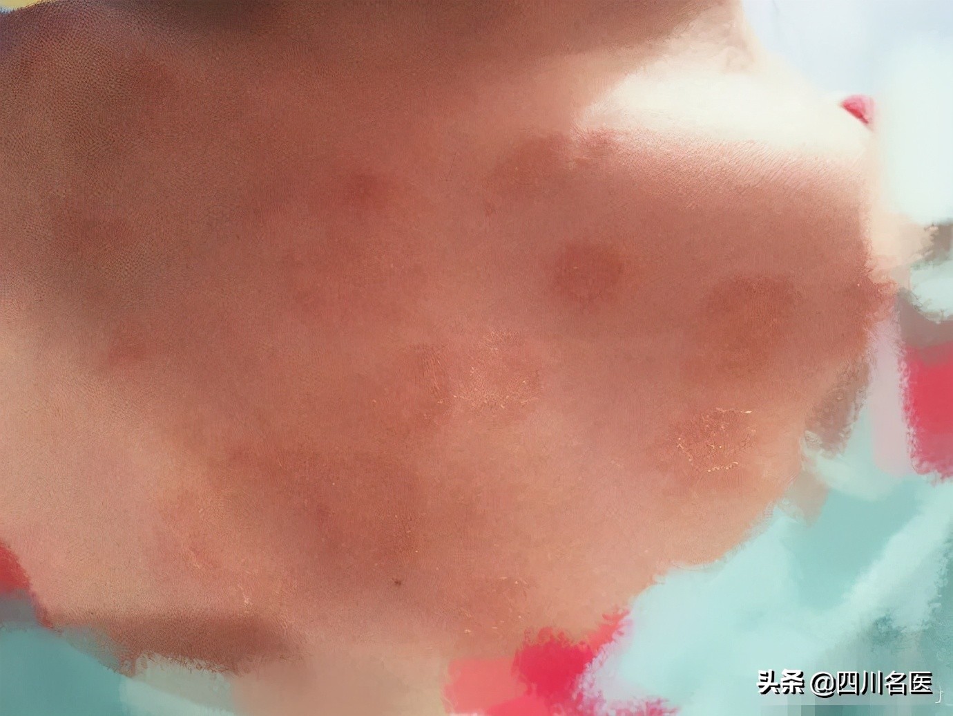 这种皮肤病用什么方法治疗好,很可怕的一种皮肤病叫啥