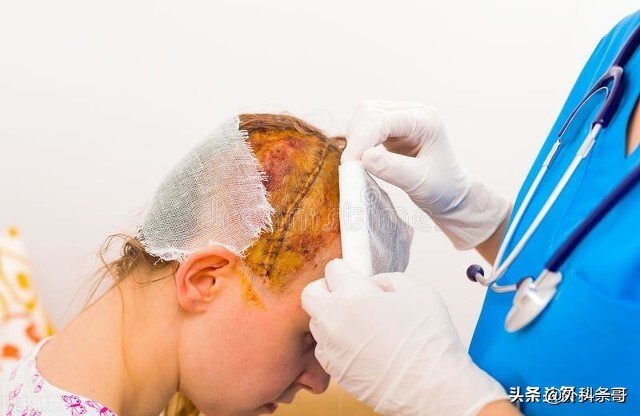 脑出血脑疝开颅手术后遗症,脑出血后遗症偏瘫能手术治疗吗