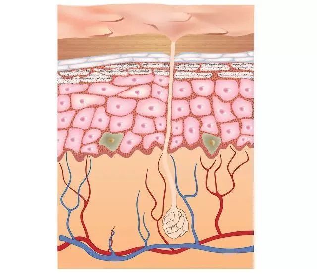 脸上泛红可以用含酒精的护肤品吗,护肤品里都含有美容酒精吗
