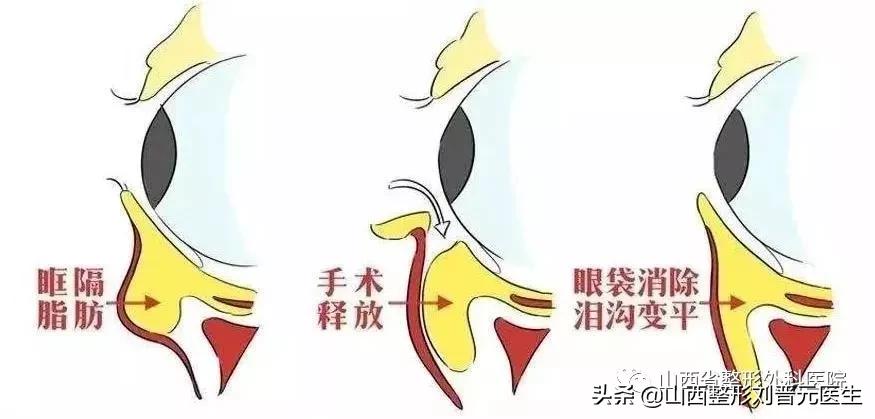 眼袋的*伤杀**力有多大？让小姐姐欲哭无泪