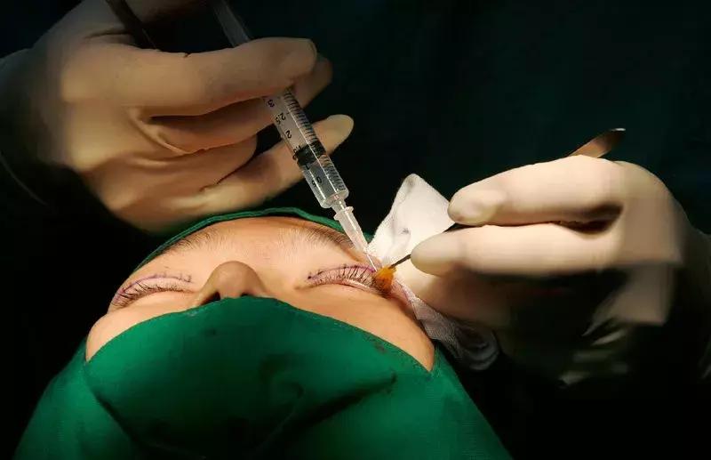 双眼皮真的有那么漂亮吗,自然双眼皮和割的双眼皮内在区别