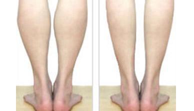 腿早晚粗细相差很大如何改善,还为腿粗而烦恼吗