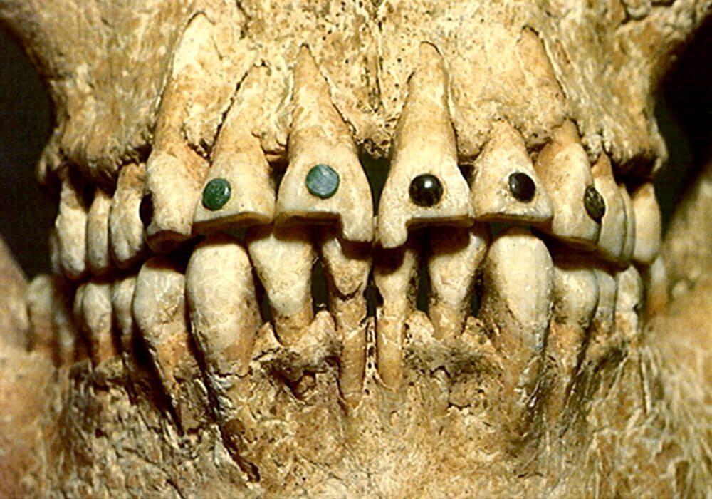 死老鼠治牙疼，尿液当漱口水，这些古人治牙全凭想象力