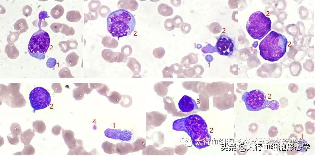 浆质体是什么,浆质体图片