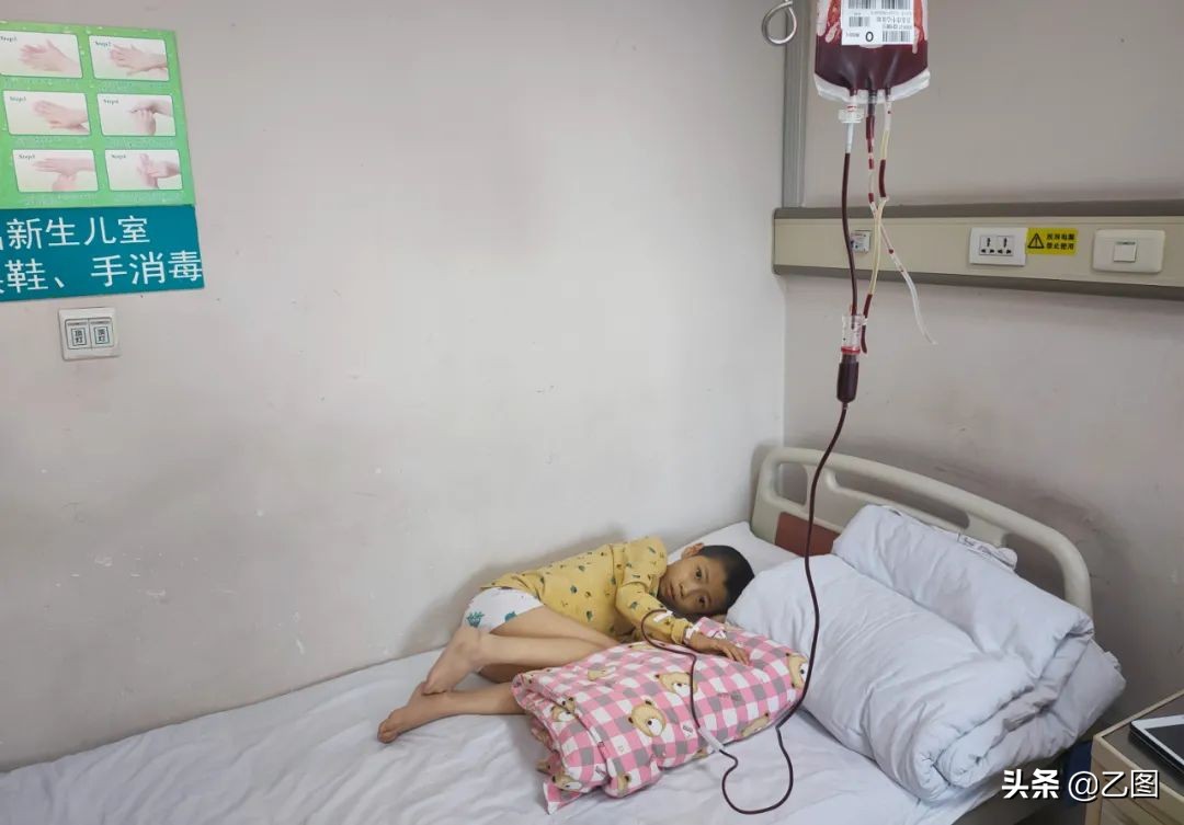 孩子四年经历三次手术,男孩4次开腹手术