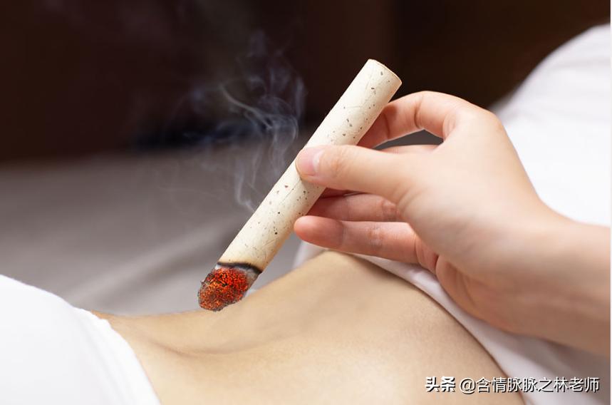 左点艾灸智能盒,左点小艾智能艾灸盒随身灸