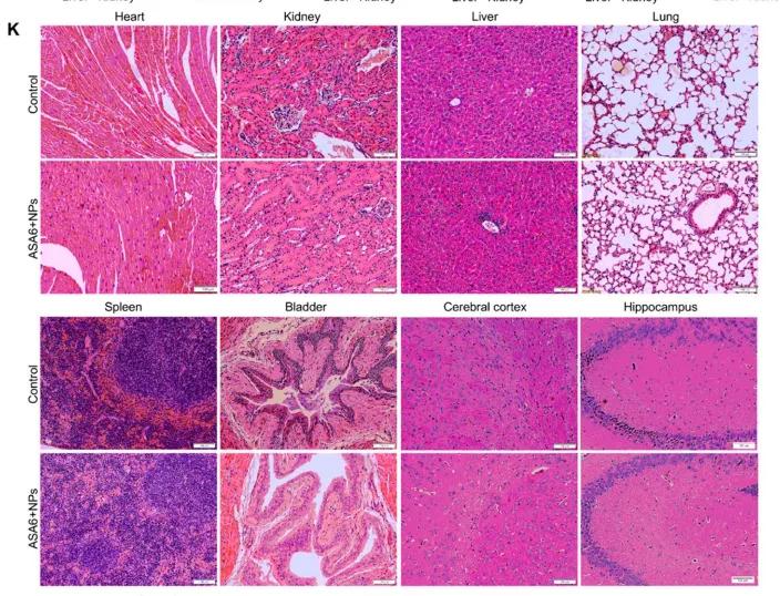 动脉粥样硬化靶向特效药,动脉粥样硬化最新药物研究
