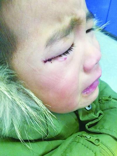 儿子误把502滴眼睛，宝妈反应迅速医生夸奖，但家长不能跟一辈子