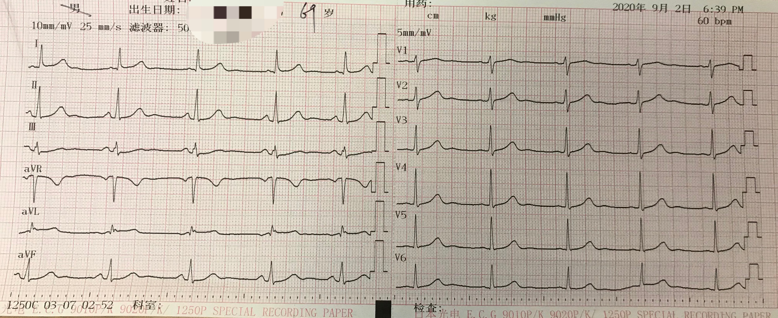 治疗快速性心律失常如何选药,心律失常频发性早搏怎么治