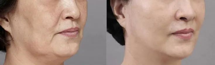 掉头发虽不美观却让你看起来像个专家，但掉牙不会