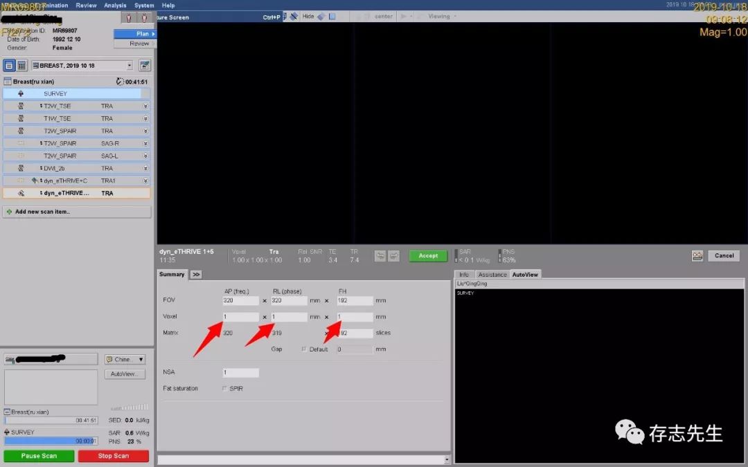 乳腺磁共振亲身经历,磁共振乳腺动态增强扫描全过程