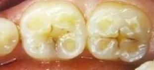 你的牙齿变黄了怎么办,你的牙齿为什么会那么白