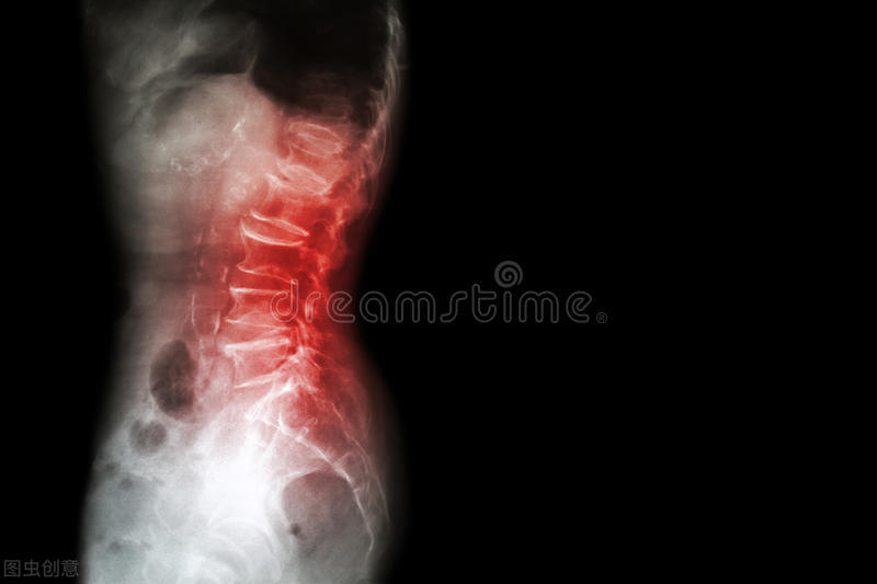 崩漏论治原则,崩漏如何止血