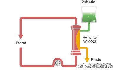 血液透析是怎么回事,血液透析失衡的症状及处理措施