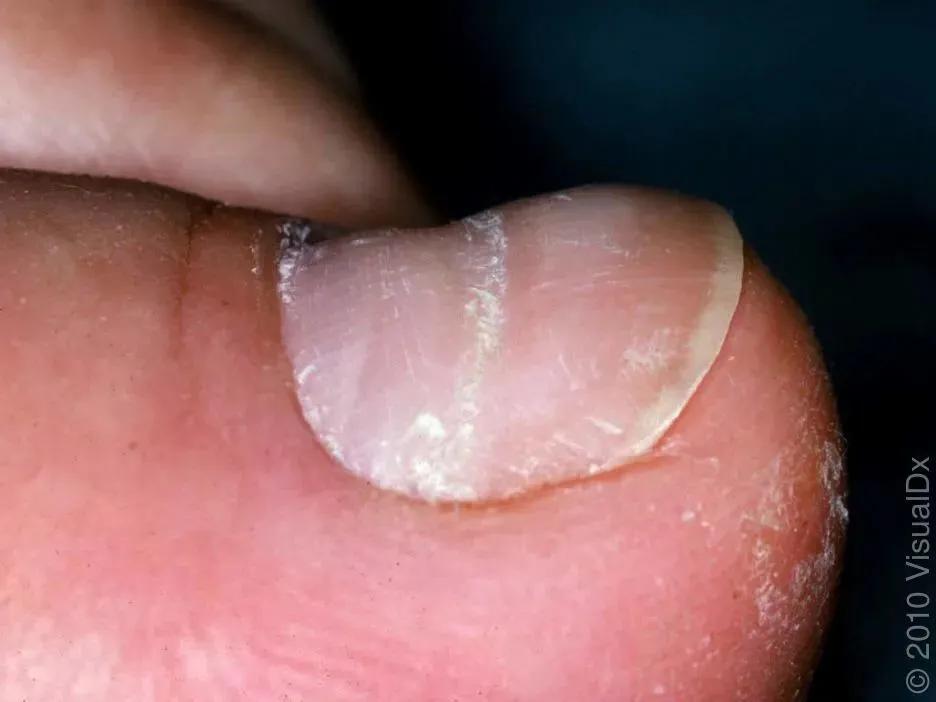 美甲的指甲怎么养护才好看,如何不做美甲就能让指甲变得精致