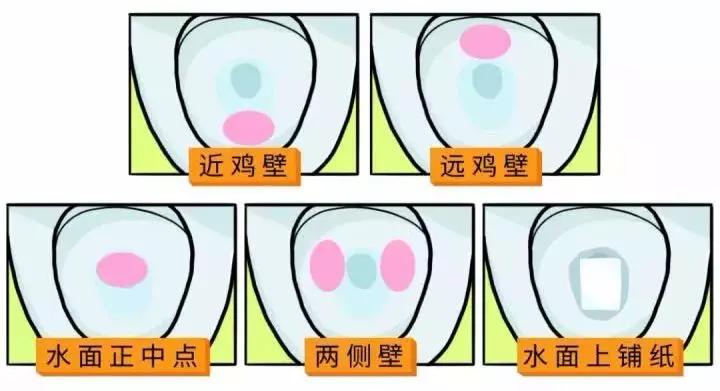 尿尿尿的到处都是?送你一份男生尿尿的最强攻略