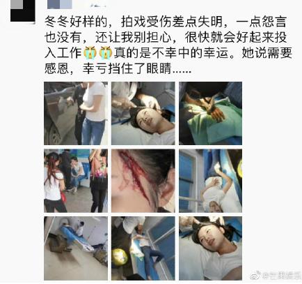 某女星因胸部被打码引争议，当事人回应：身体发育又不是见不得人