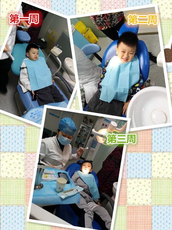 窝沟封闭预防龋齿会有什么危害吗,窝沟封闭后将有效预防孩子龋齿