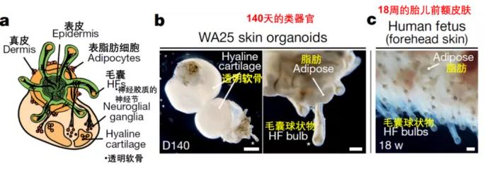 脱发治愈研究,困扰当代年轻人的脱发