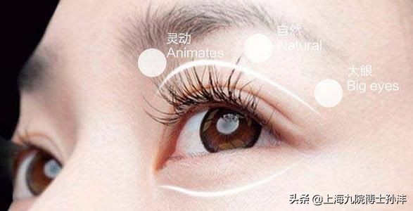 做了埋线为什么感觉睁不开眼睛,之前是埋线再做全切有影响吗