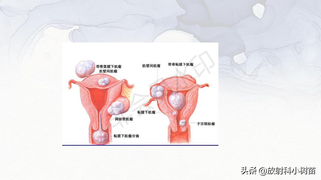 女性盆腔mri解剖图谱,泌尿生殖系统x线解剖