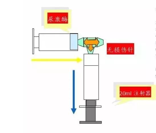 picc反复堵管什么原因,picc堵了要立马做处理吗