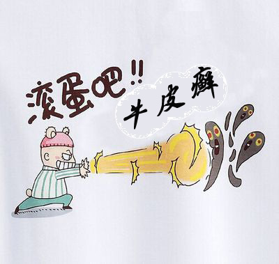 对于牛皮癣我是认真的！