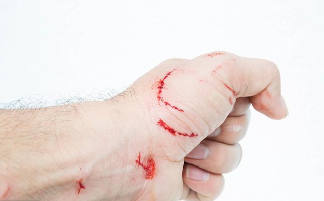 古代怎么治狂犬病,古代是怎么治狂犬病的