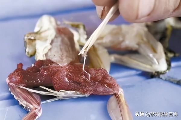 怎么知道自己感染裂头蚴寄生虫,有裂头蚴寄生虫有什么症状