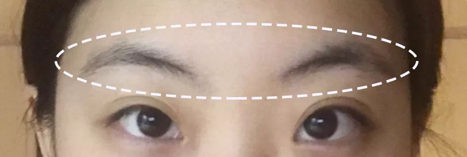 求改善痘痘真实办法,想改变脸上痘痘