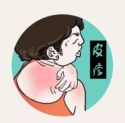 宝宝身上的痱子和热疹怎么区分,婴儿痱子和皮疹的区别