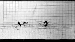 孩子膀胱容量130,儿童最大膀胱容量197正常吗