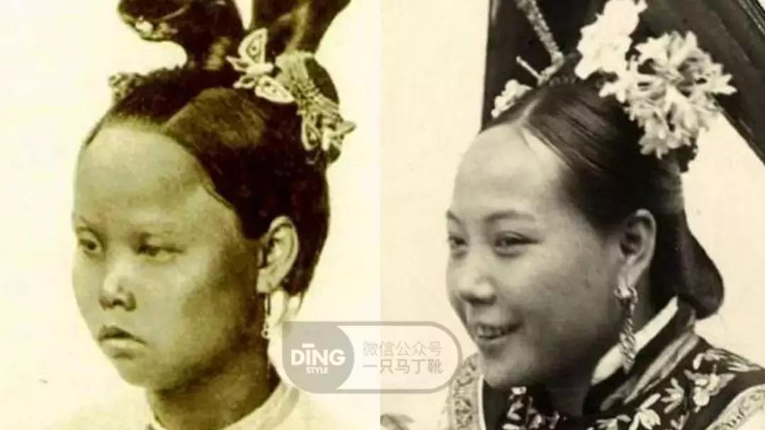 扁头怎么让头变得饱满些,扁头怎么办最快最有效