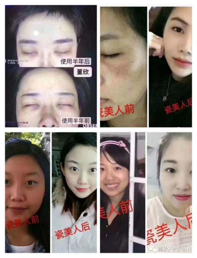 董欣瓷美人苹果干好用？董欣可靠吗？代理有啥要求？有图有真相！