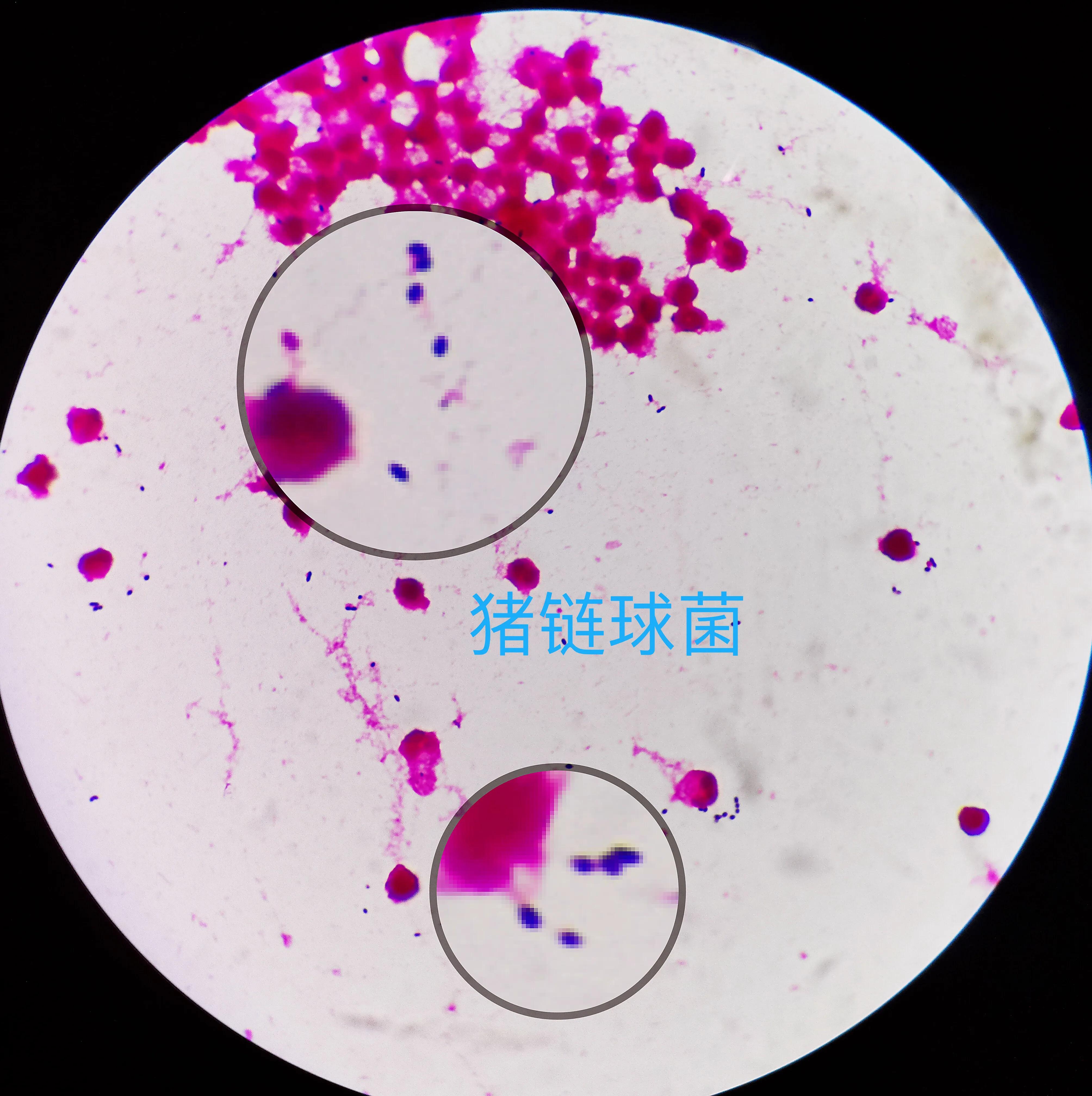 猪肉携带有病菌？感染到人体怎么办？预防措施要做好