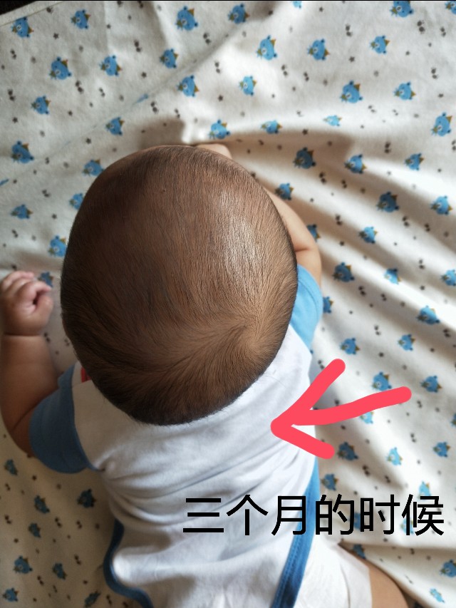 偏头的宝宝要如何调整过来,纠正宝宝偏头的小妙招