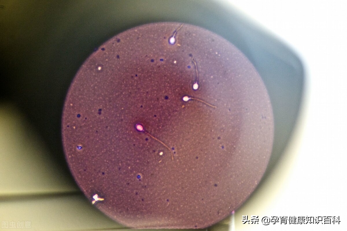 去医院检查不孕不育怎样委婉的说,去检查不孕不育做什么准备