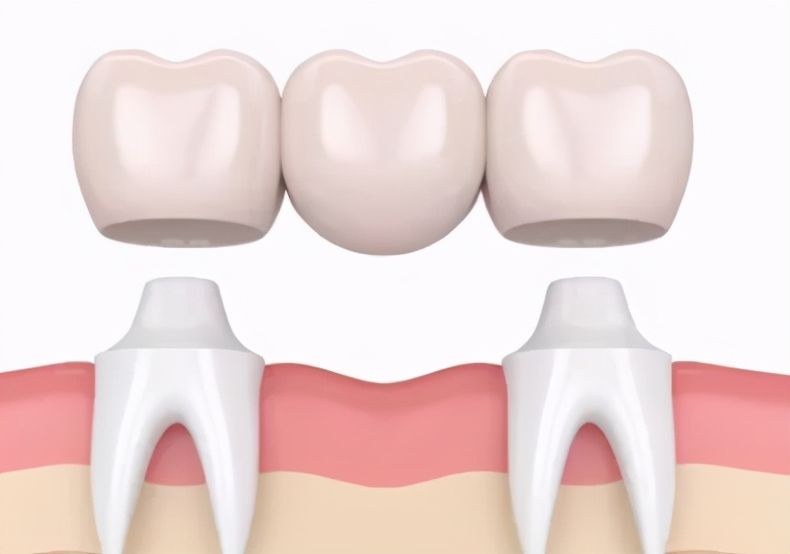 汇颜美牙齿美白,牙齿美白的牙膏