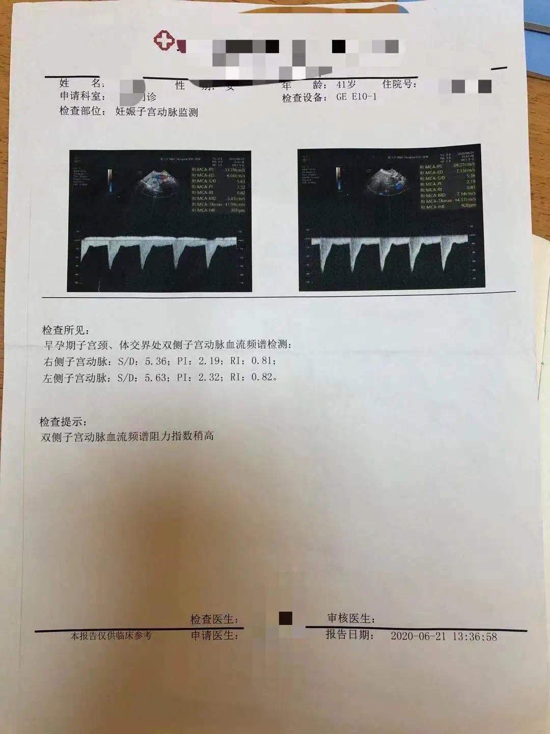 多次生化妊娠成功案例,人流后连续两次生化妊娠